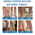 Spray Antivarizes Timilk®