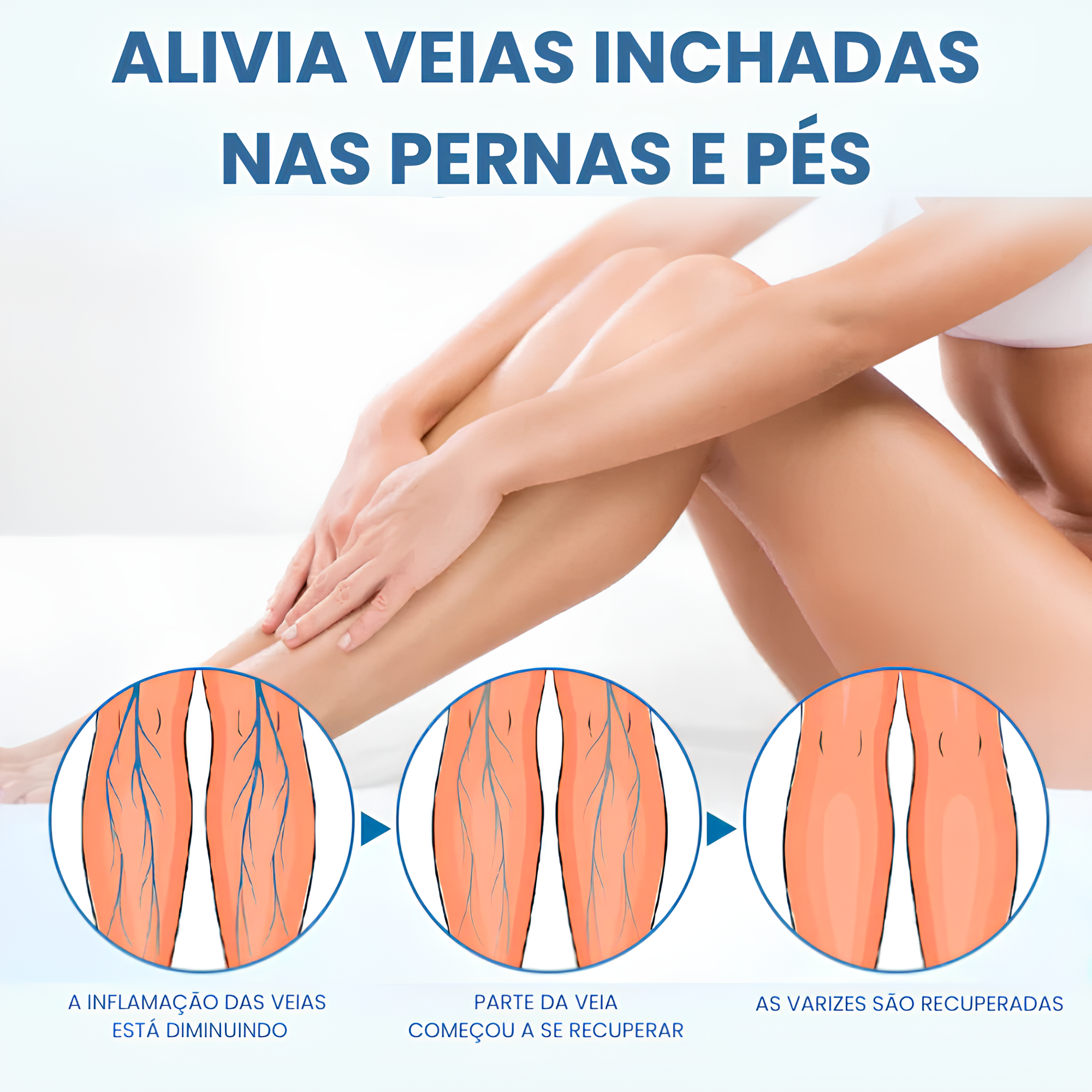 Spray Antivarizes Timilk®